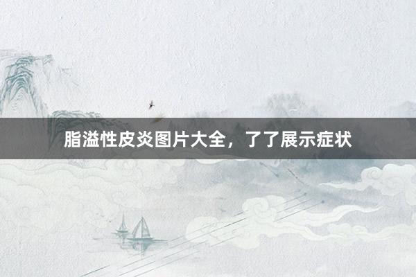 脂溢性皮炎图片大全，了了展示症状